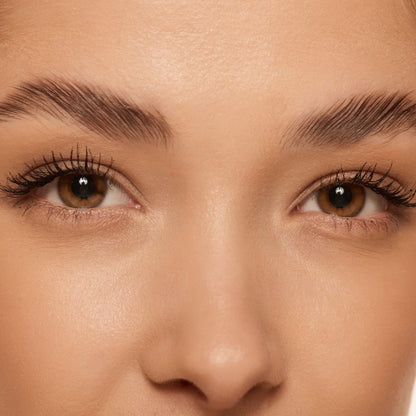 BROW LIFT